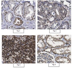 MilliporeSigma Rabbit anti-TRIM11, Polyclonal, 100&mu;g:Antibodies, Polyclonal
